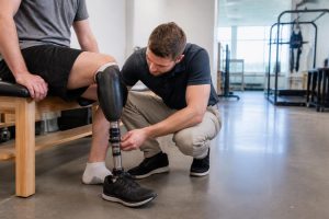 Robotic prosthetics need proof outside the lab